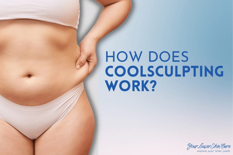 CoolSculpting® How it Works